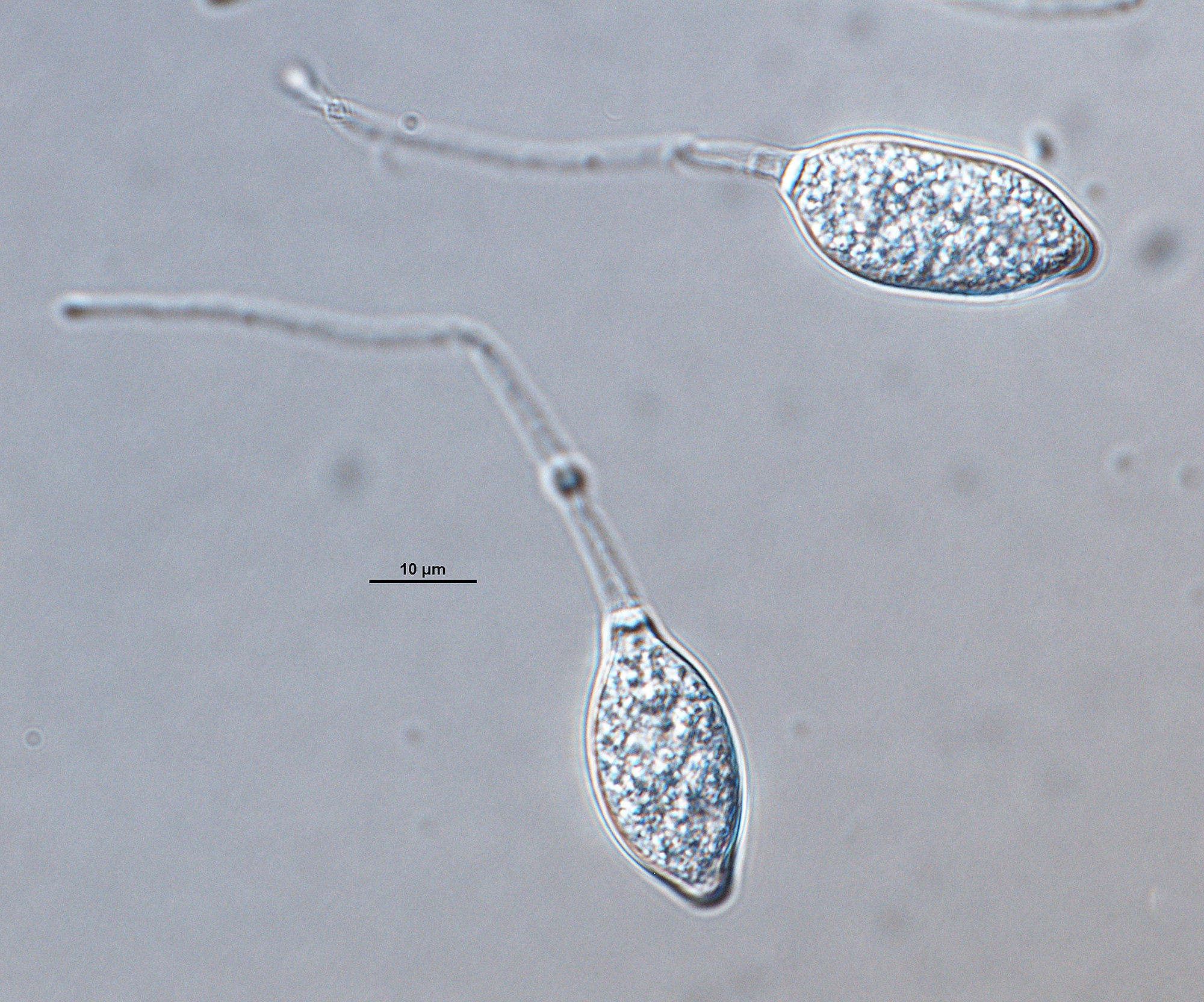   Phytophthora tropicalisnbsp; asexual phase of ex-type CPHST BL 58 formed on V8 agar flooded with soil extract:nbsp;sporangianbsp;papillate, caducous with long pedicels; photonbsp;by Gloria Abad, USDA-APHIS-PPQ. 
